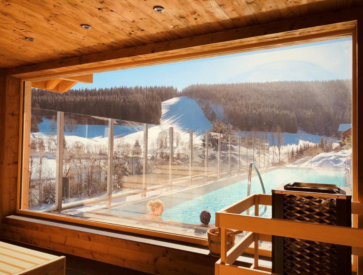 Hotel Schlehdorn เฟลด์แบร์ก ภายนอก รูปภาพ